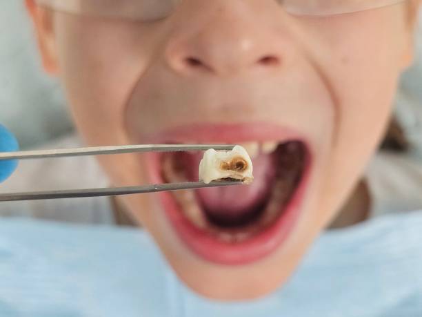Best Pediatric Emergency Dentist in Hooper, NE